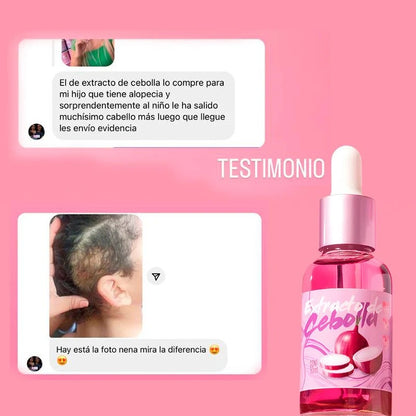 SOY RIZOS - Extracto de Cebolla (50ml)